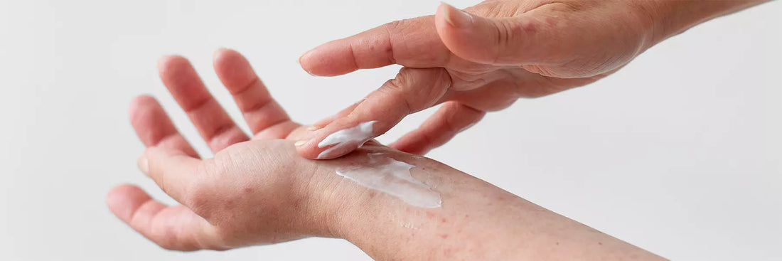 cbd-para-dermatitis-atopica