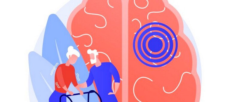 ¿El cbd ayuda a la esclerosis múltiple?